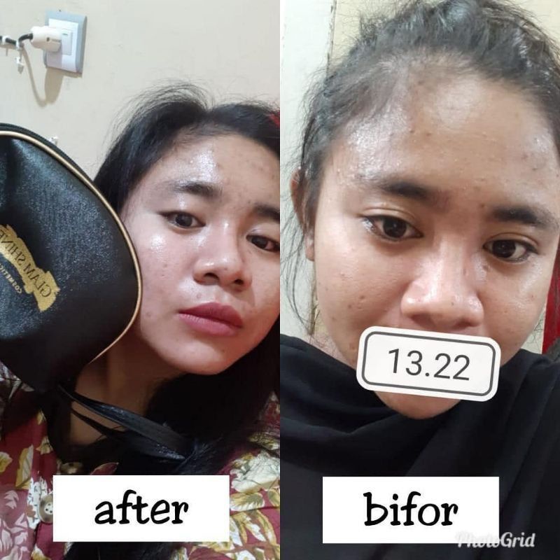 glamshine gold series - cream glamshine - glamshine cream glowing - glamshine black - glamshine platinum - glamshine gold - cream glamshine - skincare glamshine - glamshine Skincare