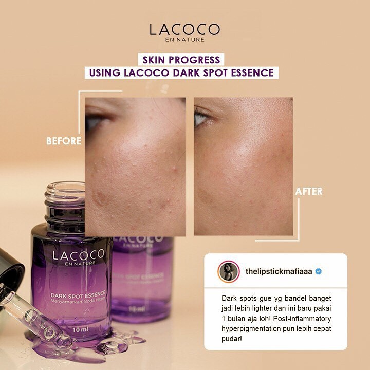 [PROMO SPESIAL] BPOM LACOCO DARK SPOT ESSENCE 12ml Anti Flek Hitam Penghilang Noda Hitam Wajah ORI