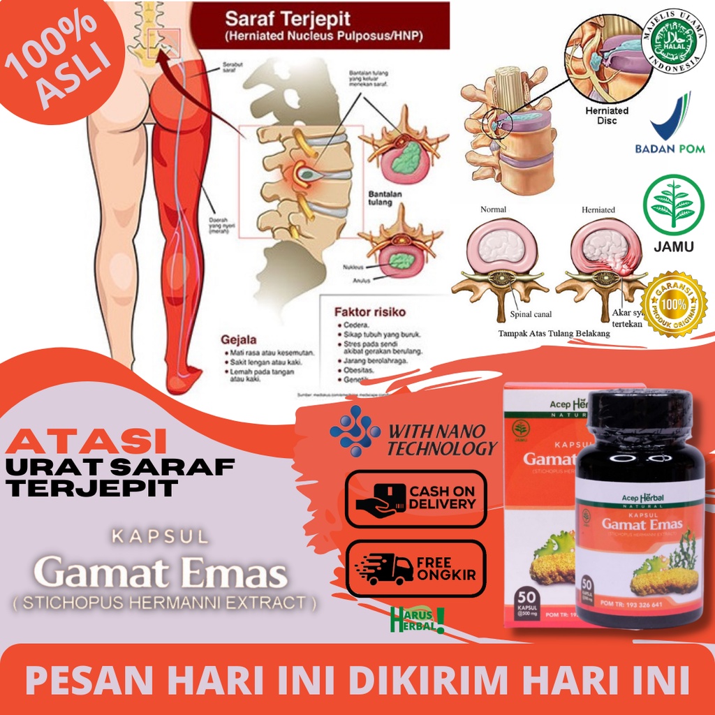 Jual Obat Saraf Kejepit HNP Sarap Terjepit Pinggang Tulang Ekor Bawah