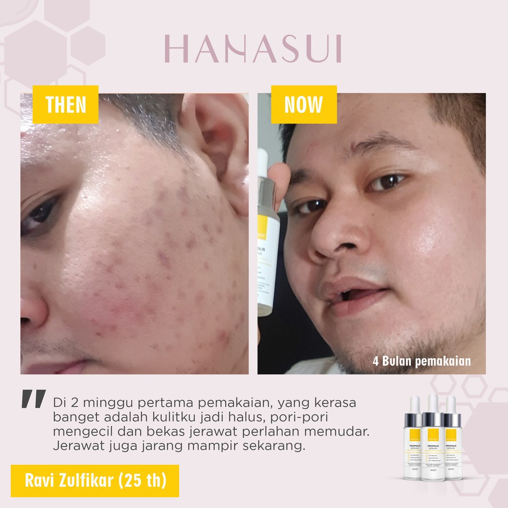 ✨ AKU MURAH ✨Hanasui Propolis Serum 25ml / Hanasui Premium Serum