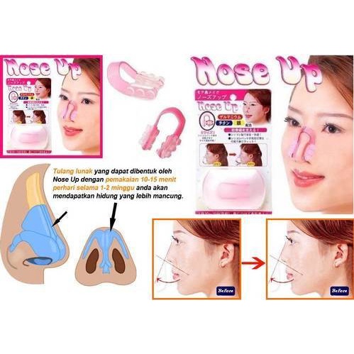 NOSE UP (Pemancung Hidung)