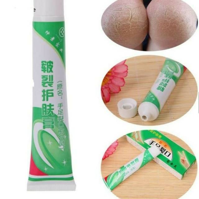 Ready Cream Anti Crack Tumitku