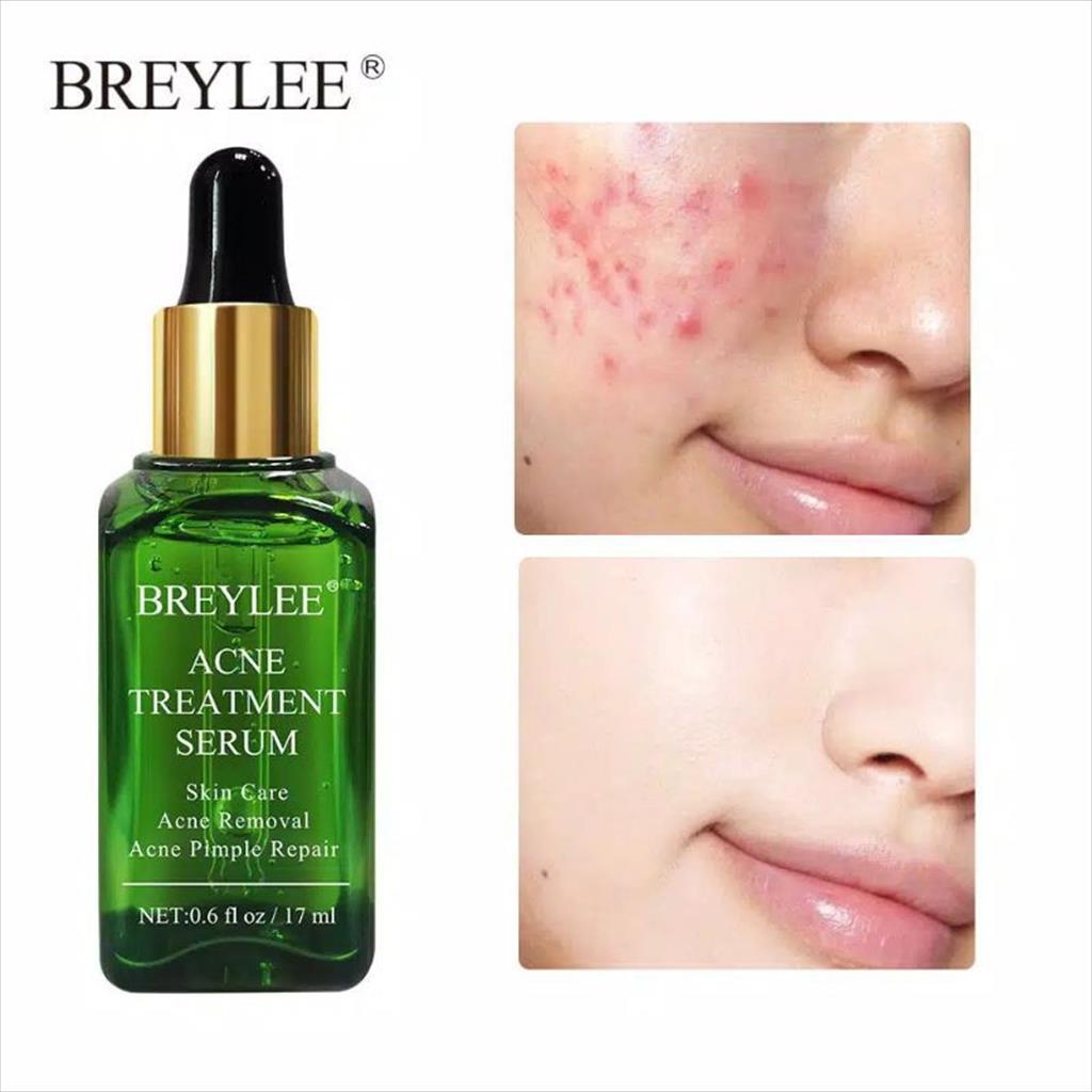 BREYLEE ACNE TREATMENT SERUM TEA TREE OIL 17ML