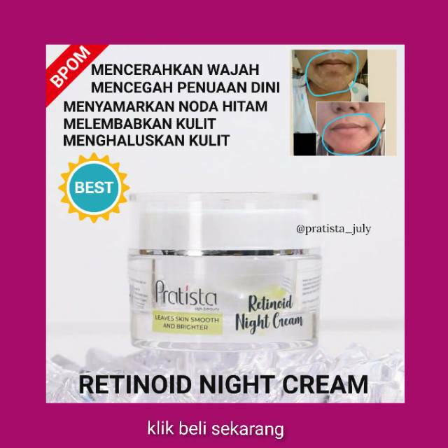 KRIM MALAM FLEK RETINOID NIGHT CREAM PRATISTA PENGHILANG FLEK HITAM DI WAJAH