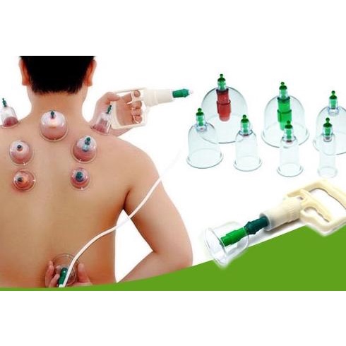 KOP ANGIN ALAT GANTI KEROKAN AMPUH ATASI MASUK ANGIN BADAN JADI ENAK