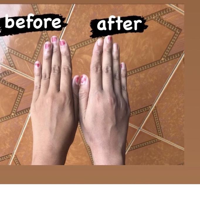 ➨ Ycha Beauty Extra White Radiant & Youth Skin Lotion ☂