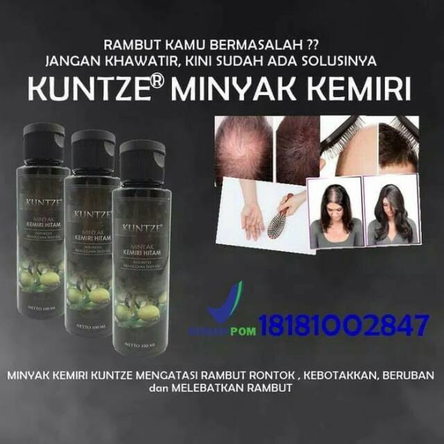 MINYAK KEMIRI HITAM KUNTZE ASLI 100 % ASLI