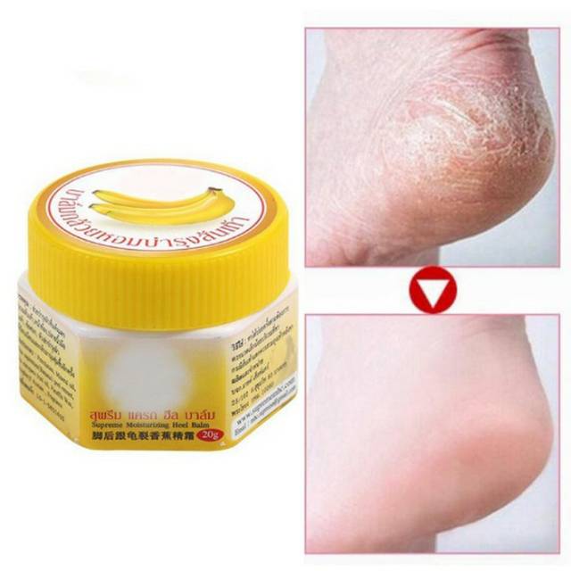 Ready Cream Kaki Pecah Pecah Dengan Cream Kaki