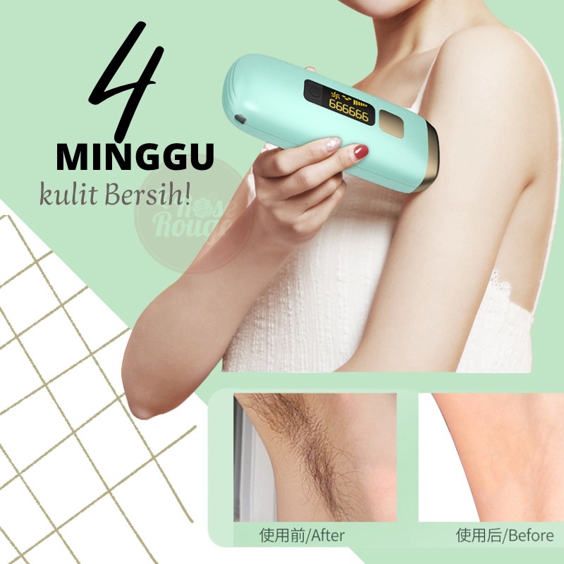 IPL Laser Hair Removal Perontok Bulu Permanent Alat penghilang bulu Tanpa SAKIT bergaransi Flash 990000