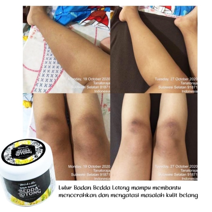 Mabello lulur pemutih badan mabelo lulur badan bedda beda lotong lotong lontong lulur hitam pemutih badan