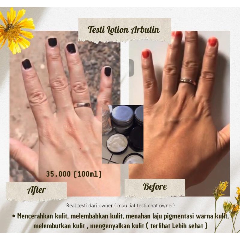 Body Lotion Arbutin | Body Lotion Whitening | HB Arbutin