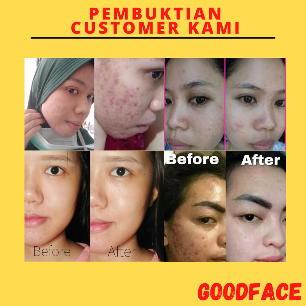 Pelembab Wajah Berminyak Whitelab Cera-Mug Barrier Moisturizing Gel Perawatan Wajah