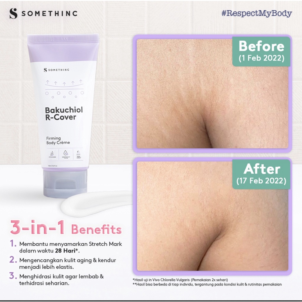 SOMETHINC Bakuchiol R-Cover Firming Body Crème - Krim Menyamarkan Strech Mark