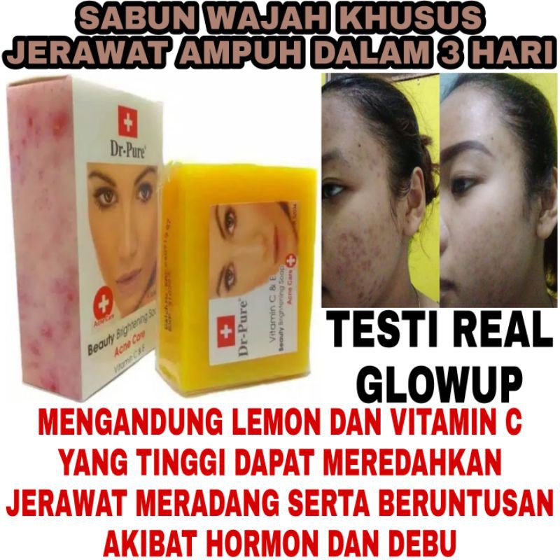 SABUN WAJAH BERJERAWAT DR PURE ACNE CARE BEAUTY BRIGHTENING SOAP BPOM - SABUN JERAWAT DR PURE