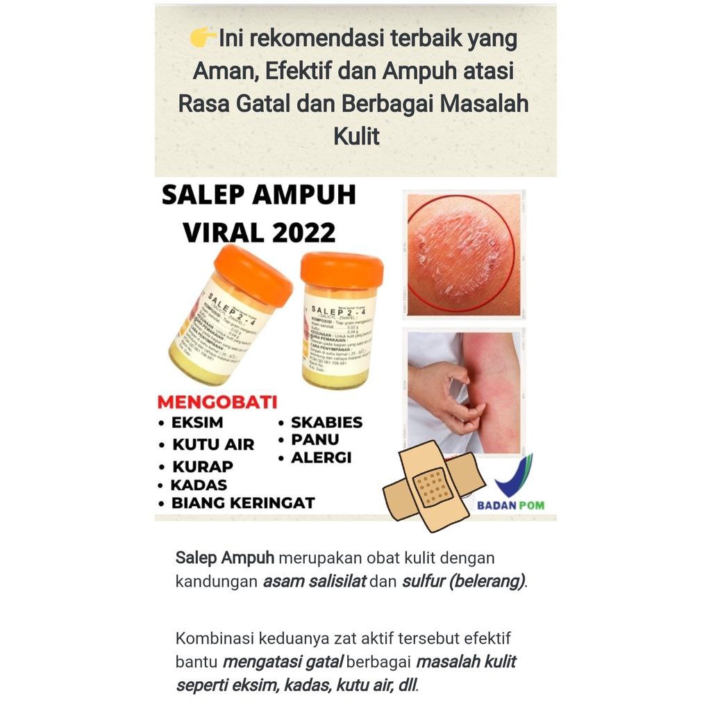 Salep zwafel 24 Obat Salep Gatal Paling Ampuh Gatel Kulit  Kadas Jamur Eksim Kutu Air Jerawat Selangkangan