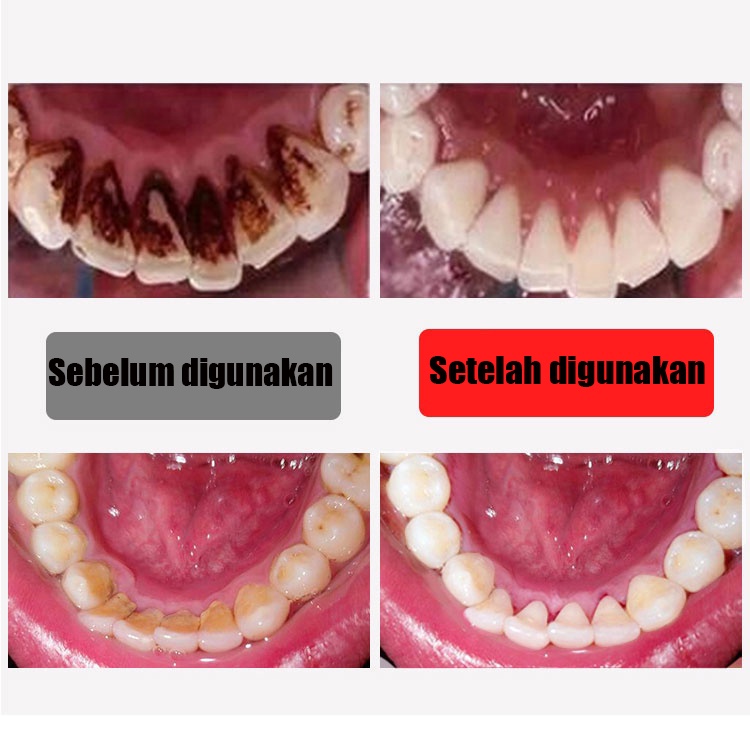 Pasta Gigi pemutih Pemutihan Gigi penghilang plak Gigi ajaib baking soda tooth paste Mencerahkan Gigi Dan Karang Gigi ORIGINAL 100%