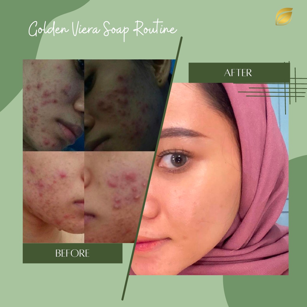 ❤️ RG ❤️ SABUN GOLDEN VIERA SOAP ORIGINAL