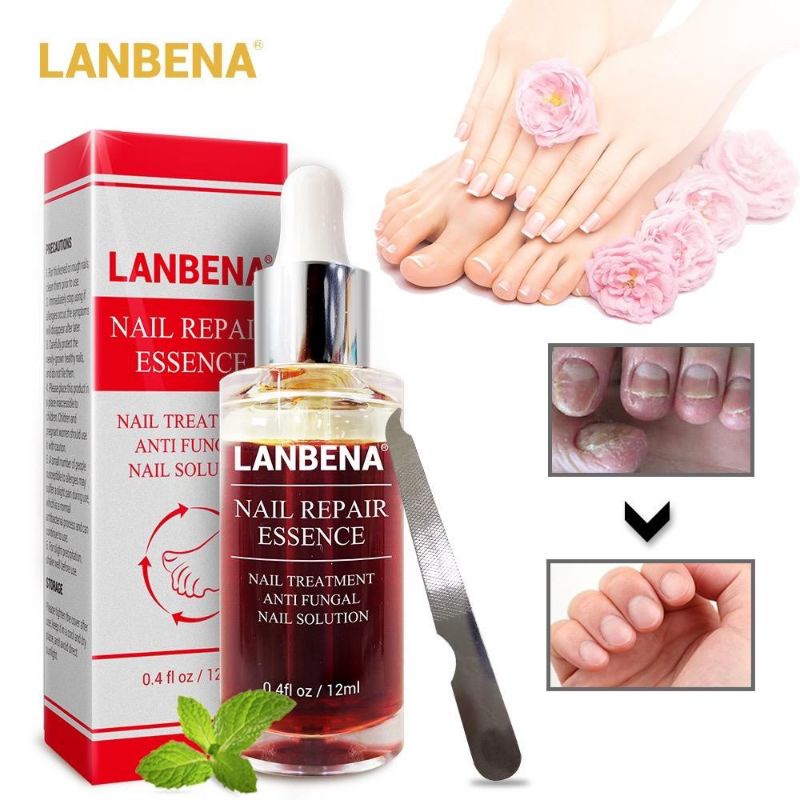 LANBENA Nail Repair Serum Jamur Perawatan Kuku Perawatan Tubuh 12ml BPOM