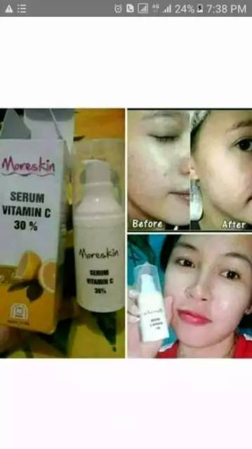 moreskin serum vitamin c 30% svitc - svitc30 berbpom murah halal-6