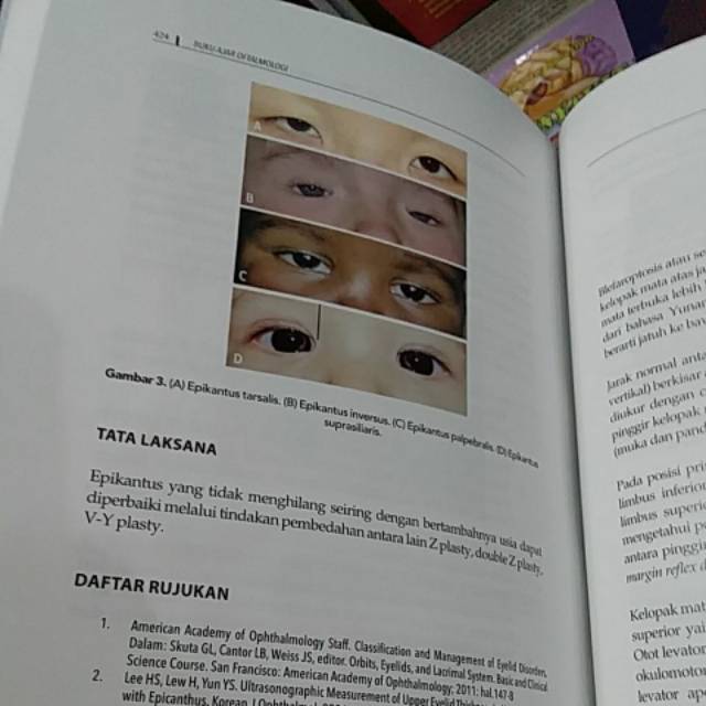 ( ORIGINAL ) BUKU AJAR OFTALMOLOGI EDISI 1 FKUI Th.2020