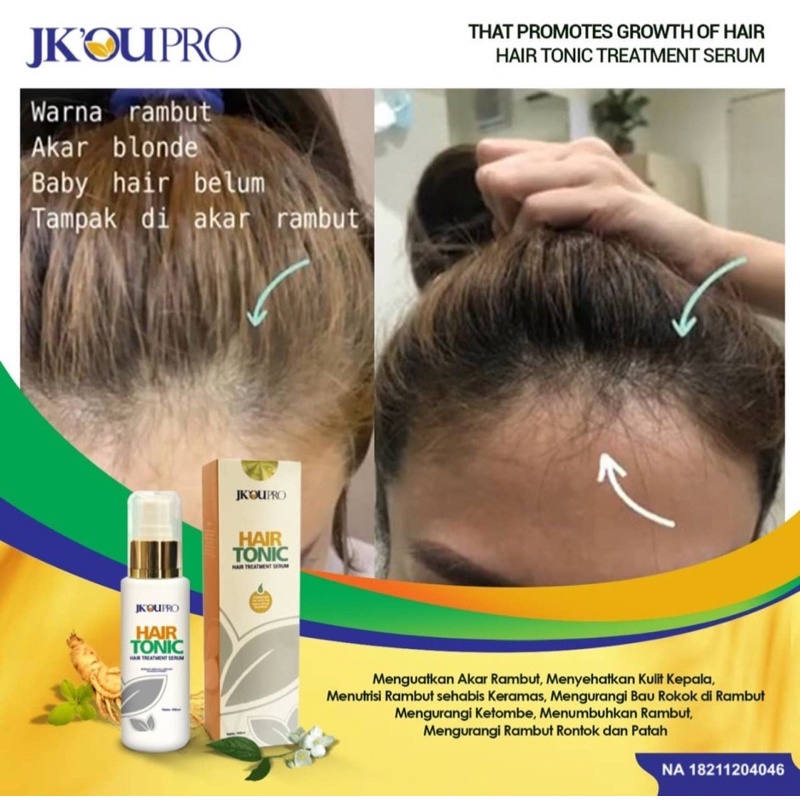 JK Oupro Hair Tonic Treatment (ready stock)
