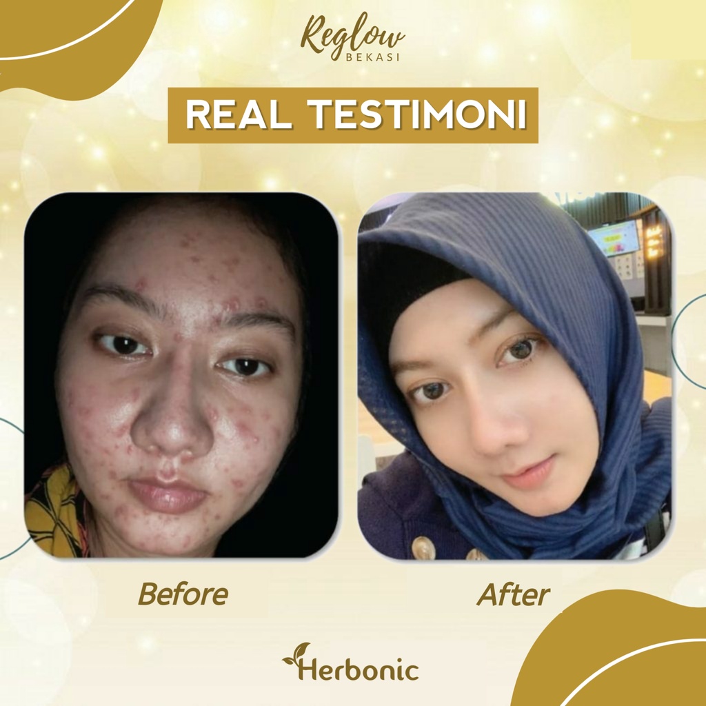 REGLOW Skincare dr Shindy Putri BPOM HALAL Original 100% Perawatan Kecantikan Wajah Glowing Skin Treatment-8