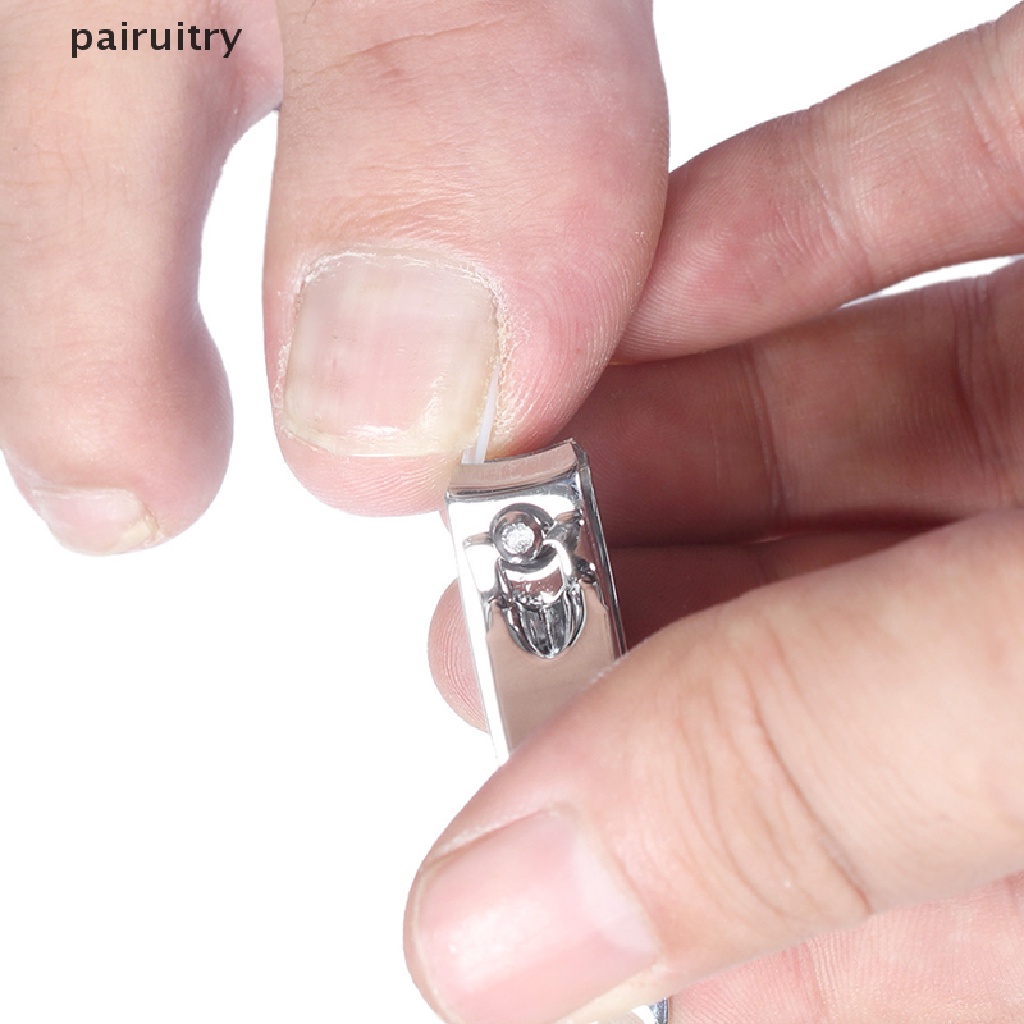 Prt 10pcs Pad Koreksi Kuku Kaki Ingrown Ortopedi PRT