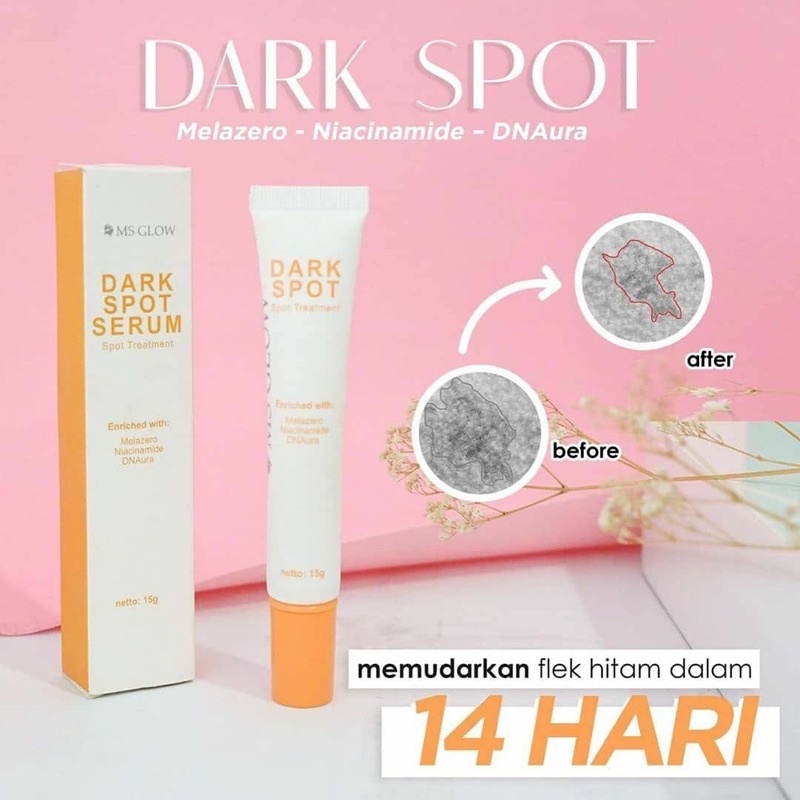 【Official Store】MS GLOW Acne spot Darkspot Pore away Msglow Spot Treatment