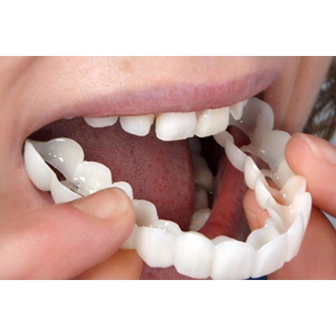 laristerus79 SNAP ON SMILE sepasang atas bawah veneer gigi palsu S009