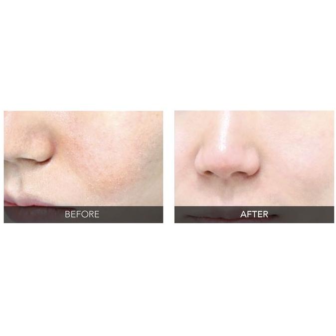 So Natural Red Tock! Spot Powder