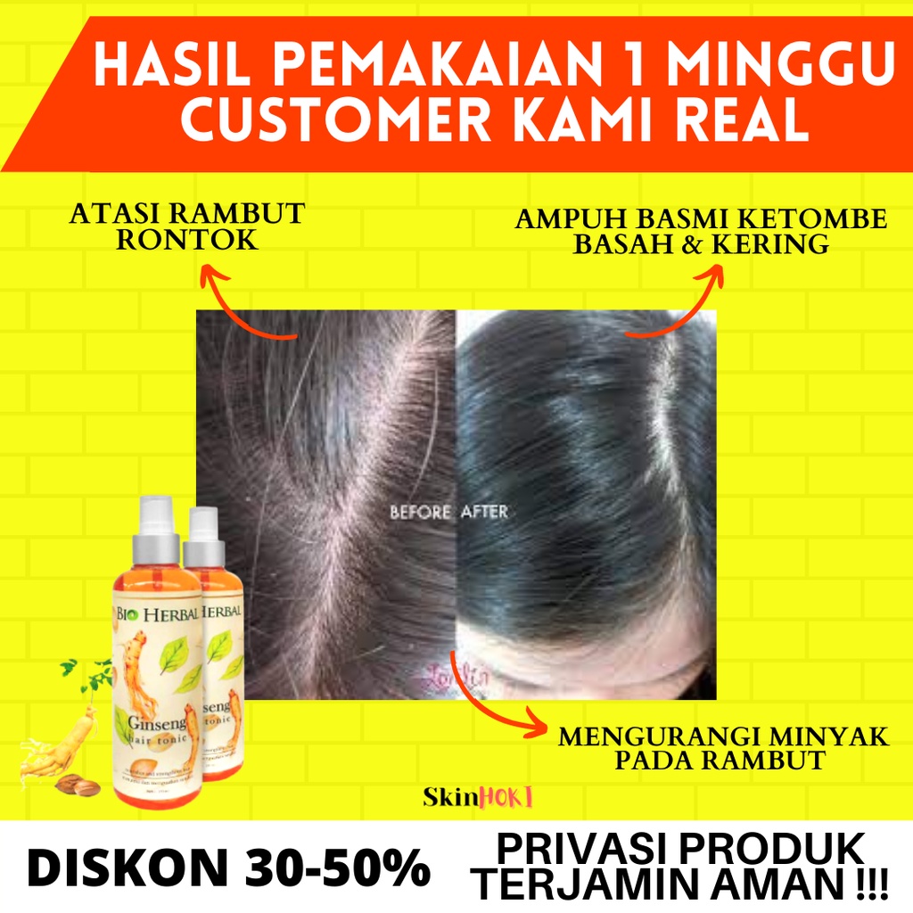 PAKET 2IN1 BIO HERBAL GINSENG PENUMBUH RAMBUT KEBOTAKAN PEMANJANG RAMBUT BIO HERBAL GINSENG &amp; HAIRTONIC BPOM ORIGINAL