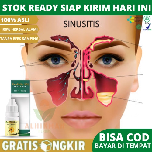 Obat Sinusitis, Obat Flu, Obat Filek, Obat Flu Menahun, Obat Filek Menahun, Obat Sinusitis Dan Polip