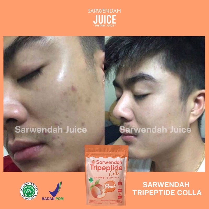 TRIPEPTIDE COLLA PEACH POUCH / COLLAGEN PEACH MENCERAHKAN BADAN WAJAH / MEMUDARKAN BEKAS LUKA SECARA ALAMI / ANTI AGING / WHITENING BOOSTER COLLAGEN