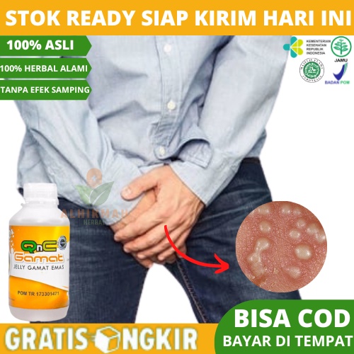 Obat Herpes Kelamin, Obat Herpes Kelamin Pria, Obat Herpes Kelamin Wanita, Obat Kulit Herpes, Obat H