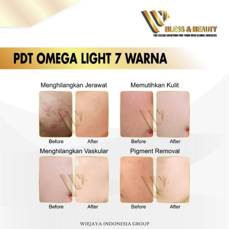 PDT LIGHT MASKER LED OMEGA LIGHT AQUA LIGHT 7 WARNA GARANSI