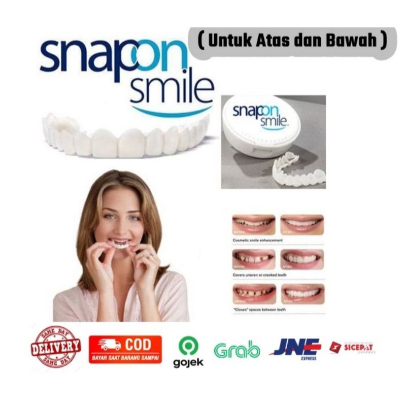 Snap On Smile Authentic / Gigi Palsu 1 set Veneer Gigi