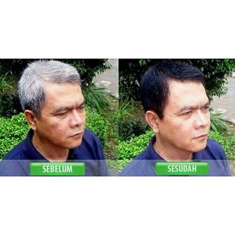 Penghitam Uban dan Penghilang Uban Permanen