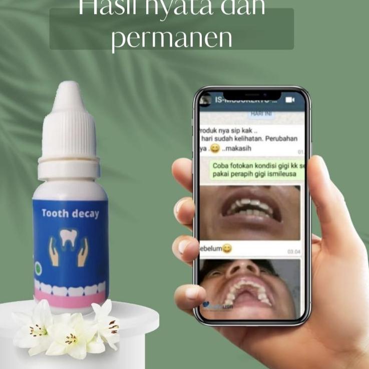 Ready Stock NG7ZD TOOTH DECAY {Penumbuh Gigi Ompong & Gigi Berlubang} BISA COD 40