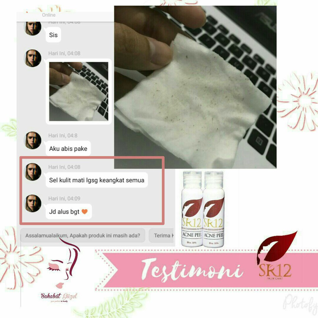SR12 Acne Peel - Perawatan dan Pembersih Jerawat Untuk Muka Wajah - SR12 Skincae - Skin Care