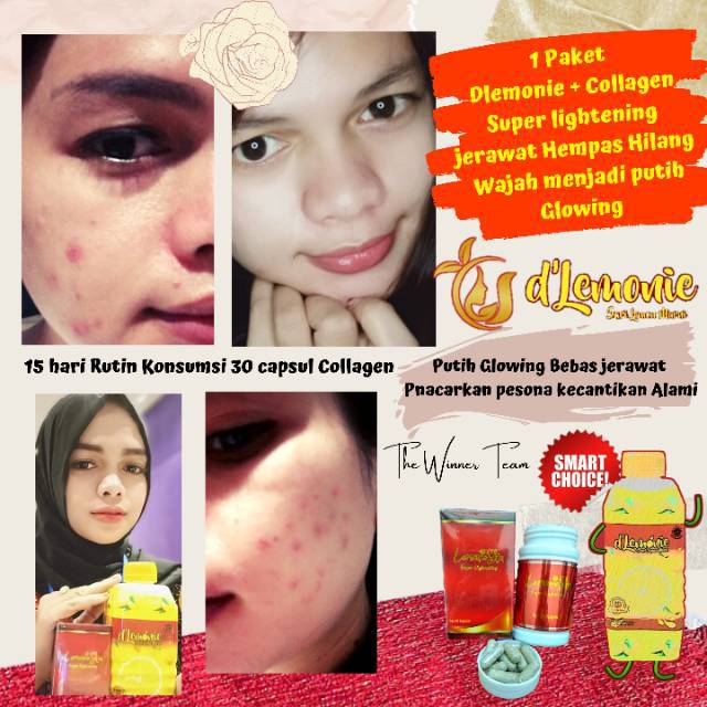 Collagen Dlemonie
