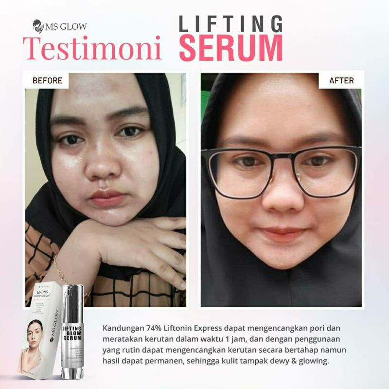 Ms Glow Lifting Glow Serum  Original 100% Serum Lifting Serum Pengencang Kulit Dan Pengecil Pori-Pori