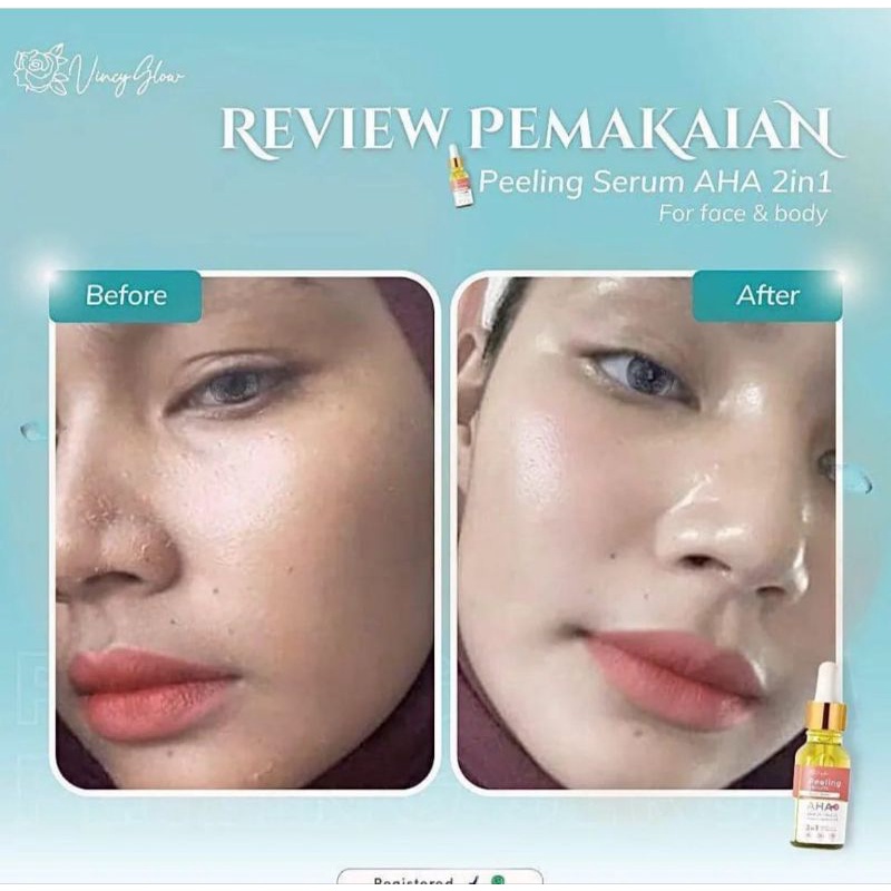 PEELING SERUM AHA ORIGINAL VINCY GLOW PUSAT RESMI