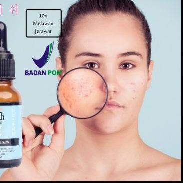 ● BISA  AISH SERUM KOREA | SERUM AISH KOREA ORIGINAL ACNE |BRIGHTENING |DARKSPOT 100% ♥