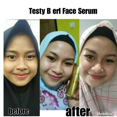 B ERL FACIAL SERUM WAJAH GLOWING ANTI AGING BERL KOSMETIK B ERL COSMETICS berlcosmetics serum wajah