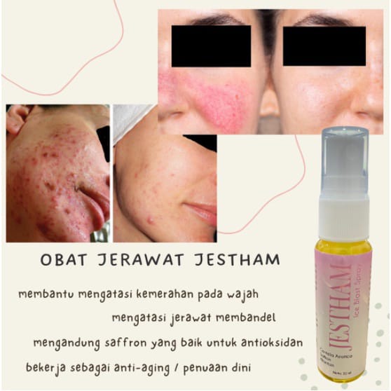 BARU  SPRAY DOUBLE GLOW JESTHAM/ GLOW WATER ICE BLAST JESTHAM UNTUK MEREDAKAN JERAWAT