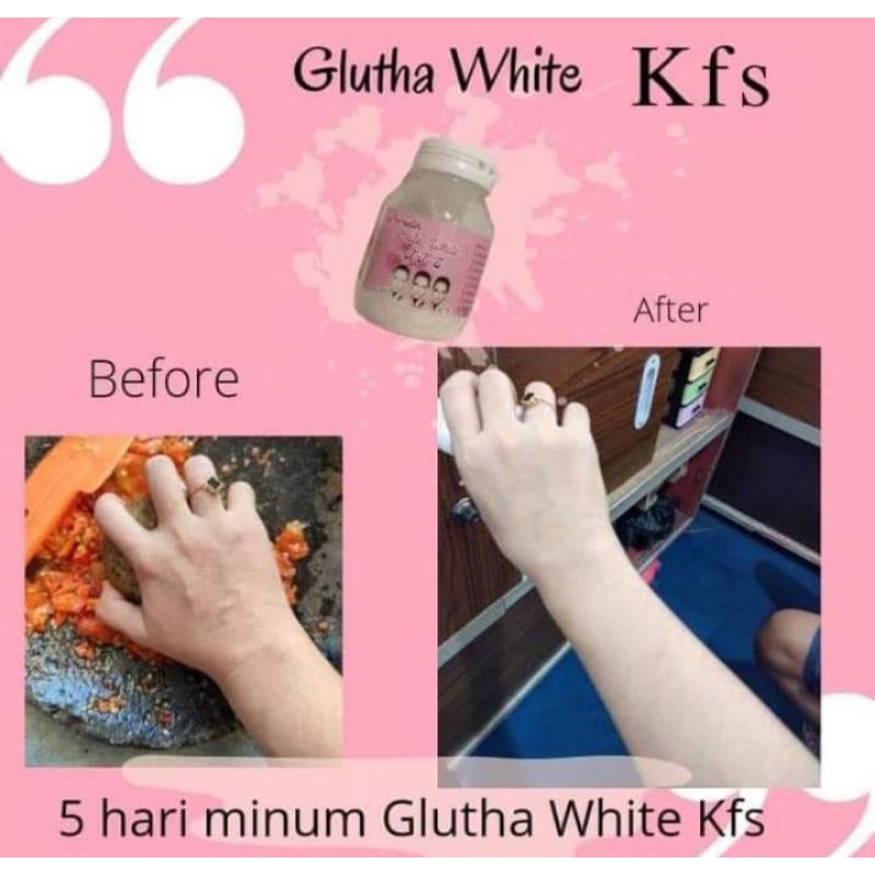 kfs skincare(gluta white)