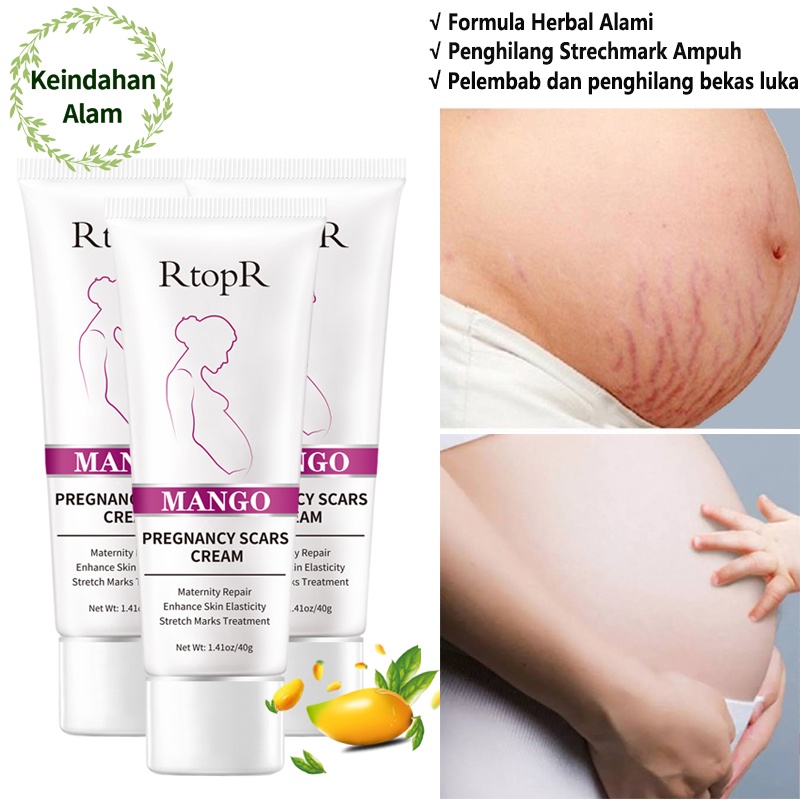 Rtopr Stretch Mark Cream  - Penghilang Strech Mark / Bekas Luka Ampuh Oermanen bpom Krim Stretch Mark