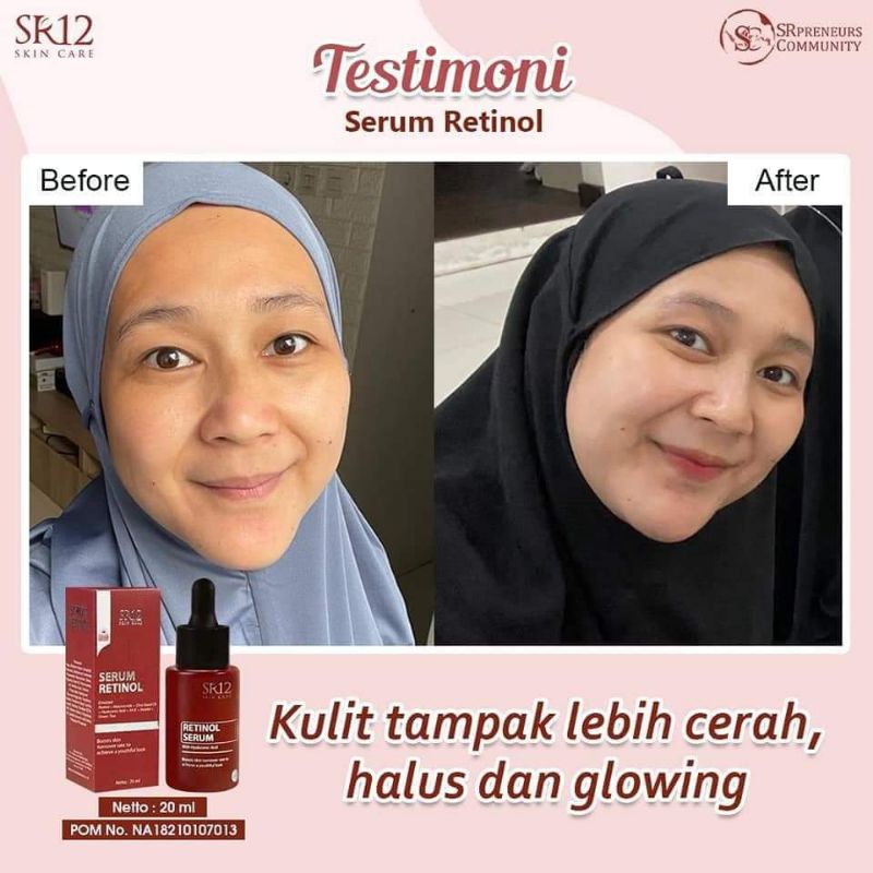 SERUM RETINOL SR12 GLOWING / SERUM WAJAH/ SERUM RETINOL BPOM/SERUM VIRAL PENGHILANG JERAWAT/ SERUM ANTI AGING