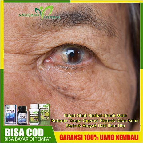 Paket Obat Herbal Untuk Mata Ketarak Tanpa Operasi Ekstrak Daun Kelor/Ekstrak Minyak Hati Ikan Hiu |