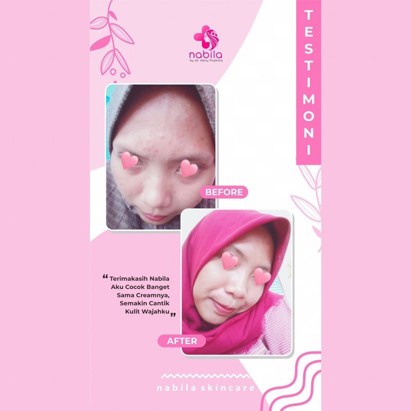 SUNSCREEN SENSITIVE SPF 30 | NABILA | NABILA SKINCARE | NABILASKINCARE